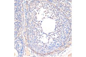 Immunohistochemistry of paraffin-embedded rat ovary using SM antibody (ABIN6128714, ABIN6148090, ABIN6148091 and ABIN6218232) at dilution of 1:200 (40x lens). (SMAD5 antibody  (AA 186-465))
