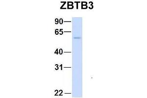 Host:  Rabbit  Target Name:  CHAD  Sample Type:  Human Adult Placenta  Antibody Dilution:  1. (ZBTB3 antibody  (Middle Region))