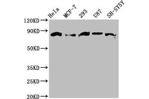 Western Blot Positive WB detected in: Hela whole cell lysate, MCF-7 whole cell lysate, 293 whole cell lysate, U87 whole cell lysate, SH-SY5Y whole cell lysate All lanes: BARD1 antibody at 3.