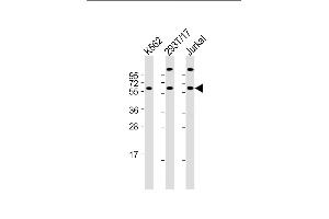 All lanes : Anti-Hsp 60 Antibody (N-term) at 1:2000 dilution Lane 1: K562 whole cell lysate Lane 2: 293T/17 whole cell lysate Lane 3: Jurkat whole cell lysate Lysates/proteins at 20 μg per lane. (HSPD1 antibody  (N-Term))