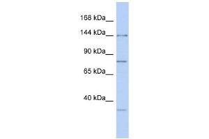 RNASEN antibody used at 1 ug/ml to detect target protein. (DROSHA antibody  (Middle Region))