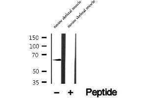 Western blot analysis of extracts of mouse skeletal muscle tissue, using CRAT antibody. (CRAT antibody  (N-Term))