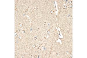 Immunohistochemistry of paraffin-embedded human brain using B Rabbit mAb (ABIN1680181, ABIN7101458, ABIN7101459 and ABIN7101460) at dilution of 1:100 (40x lens). (BCAP31 antibody)