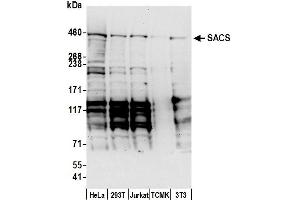anti-Spastic Ataxia of Charlevoix-Saguenay (Sacsin) (SACS) (AA 175-225) antibody