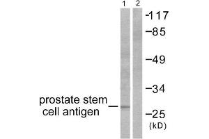 Western Blotting (WB) image for anti-Prostate Stem Cell Antigen (PSCA) (Internal Region) antibody (ABIN1848752) (PSCA antibody  (Internal Region))