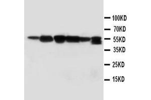 Anti-ABI1 antibody, Western blotting Lane 1: Rat Liver Tissue Lysate Lane 2: Rat Brain Tissue Lysate Lane 3: MM231 Cell Lysate Lane 4: HELA Cell Lysate Lane 5: SMMC Cell Lysate  Lane 6: JURKAT Cell Lysate