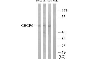 Western blot analysis of extracts from HeLa cells, Jurkat cells and A549 cells, using CBCP6 antibody. (AGBL4 antibody)
