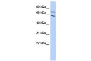 Image no. 1 for anti-Metastasis Associated 1 Family, Member 2 (MTA2) (AA 35-84) antibody (ABIN6740437) (MTA2 antibody  (AA 35-84))