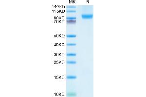 Human CD31 on Tris-Bis PAGE under reduced condition. (CD31 Protein (AA 28-601) (His tag))