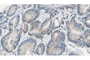 ABIN6269275 at 1/100 staining Human prostate tissue by IHC-P. (GSK3 alpha antibody  (N-Term))