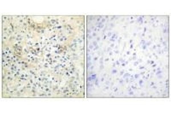 Anoctamin 7 antibody  (C-Term)