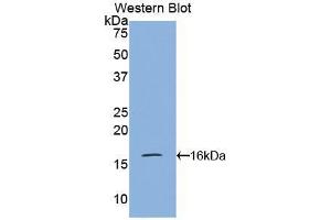 Western blot analysis of the recombinant protein. (VPREB1 antibody  (AA 43-134))