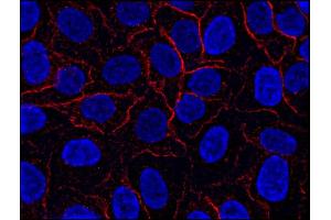 Immunocytochemistry (ICC) image for anti-AHNAK Nucleoprotein (AHNAK) (N-Term) antibody (ABIN302097)
