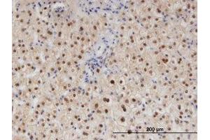 Image no. 1 for anti-RAD23 Homolog B (RAD23B) (AA 311-410) antibody (ABIN599426) (RAD23B antibody  (AA 311-410))