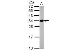 Image no. 1 for anti-ATPase, H+ Transporting, Lysosomal 31kDa, V1 Subunit E2 (ATP6V1E2) antibody (ABIN1502161)