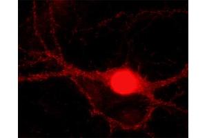 Indirect immunolabeling of cultured rat hippocampus neurons (dilution: 1 : 5000). (CTBP1 antibody  (AA 414-430))