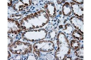 Immunohistochemical staining of paraffin-embedded Kidney tissue using anti-RIC8A mouse monoclonal antibody.
