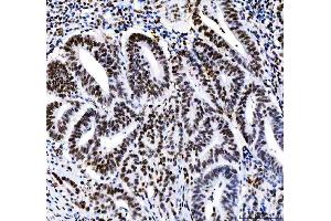 IHC analysis of HDAC2 using anti-HDAC2 antibody (ABIN7601564).