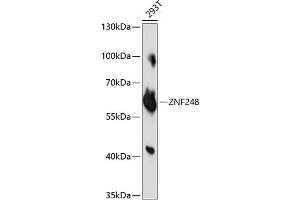 Western blot analysis of extracts of 293T cells, using ZNF248 antibody (ABIN7271470) at 1:1000 dilution. (ZNF248 antibody  (AA 1-110))