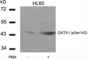 Western blot analysis of extracts from HL60 cells untreated or treated with PMA using GATA1(Phospho-Ser142) Antibody. (GATA1 antibody  (pSer142))