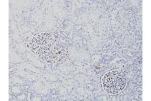 Immunohistochemical staining (Formalin-fixed paraffin-embedded sections) of human fetal kidney with WT1 monoclonal antibody, clone SPM361 . (WT1 antibody  (AA 1-181))