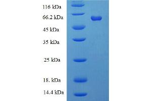 SDS-PAGE (SDS) image for Galactose-1-Phosphate Uridylyltransferase (GALT) (AA 1-379), (full length) protein (His-SUMO Tag) (ABIN5709555) (GALT Protein (AA 1-379, full length) (His-SUMO Tag))