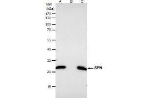 IP Image 14-3-3 sigma antibody immunoprecipitates SFN protein in IP experiments. (14-3-3 sigma/SFN antibody)