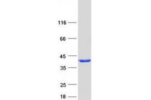 Western Blotting (WB) image for Receptor Accessory Protein 2 (REEP2) protein (Myc-DYKDDDDK Tag) (ABIN2730677)