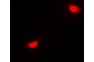 Immunofluorescent analysis of SETD6 staining in A549 cells. (SETD6 antibody)