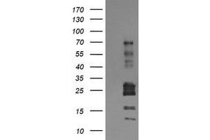 Image no. 1 for anti-Tripartite Motif Containing 22 (TRIM22) (AA 61-406) antibody (ABIN1491615) (TRIM22 antibody  (AA 61-406))