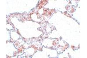 Immunohistochemistry (IHC) image for anti-MRE11 Meiotic Recombination 11 Homolog A (S. Cerevisiae) (MRE11A) (N-Term) antibody (ABIN1031460) (Mre11 antibody  (N-Term))