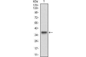 Western blot analysis using CCNE1 mAb against human CCNE1 (AA: 307-410) recombinant protein.
