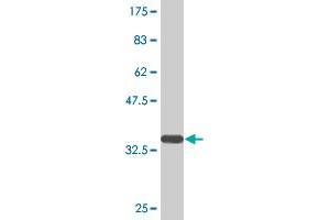 Western Blot detection against Immunogen (35. (UQCRH antibody  (AA 1-91))