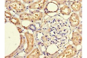 Immunohistochemistry of paraffin-embedded human kidney tissue using ABIN7152681 at dilution of 1:100 (FRMD5 antibody  (AA 295-504))