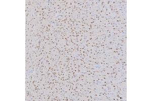 IHC analysis of SNRNP200 using anti-SNRNP200 antibody (ABIN7602032). (SNRNP200 antibody  (AA 557-2129))