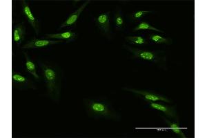 Immunofluorescence of purified MaxPab antibody to ZNF668 on HeLa cell.