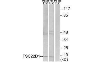 Western Blotting (WB) image for anti-TSC22 Domain Family, Member 1 (TSC22D1) (N-Term) antibody (ABIN1849646) (TSC22D1 antibody  (N-Term))