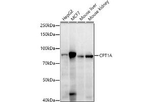 Western blot analysis of extracts of various cell lines, using CPT1A antibody (ABIN7266089) at 1:1000 dilution. (CPT1A antibody  (AA 497-756))