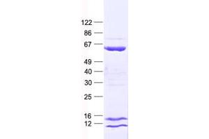 Validation with Western Blot (CCDC65 Protein (His tag))