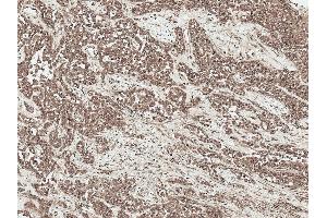 Immunohistochemistry analysis using Rabbit Anti-SFRP2 Polyclonal Antibody (ABIN5696096). (SFRP2 antibody  (AA 195-295) (HRP))