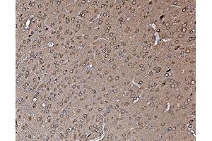 IHC analysis of Profilin 2/PFN2 using anti-Profilin 2/PFN2 antibody (ABIN7602692). (PFN2 antibody  (AA 96-138))