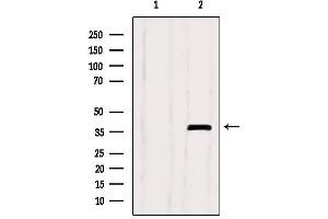 Western blot analysis of extracts from Myeloma cells, using SEPT9 Antibody. (Septin 9 antibody  (C-Term))