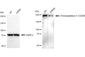 Western blotting analysis using Aminopeptidase A / CD249 antibody (ABIN7798749). (Recombinant ENPEP antibody)