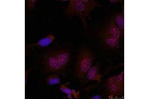 Immunofluorescence staining of methanol-fixed Hela cells using JunB(Phospho-Ser79) Antibody. (JunB antibody  (pSer79))