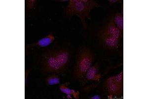 Immunofluorescence staining of methanol-fixed Hela cells using JunB(Phospho-Ser79) Antibody. (JunB antibody  (pSer79))