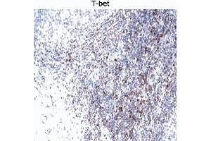 T-bet staining of human tonsil. (T-Bet antibody)