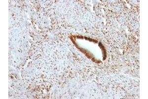 Formalin-fixed, paraffin-embedded human uterus stained with Nucleolin antibody. (Nucleolin antibody)