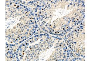 ABIN6266054 and ABIN6276599 at 1/100 staining Mouse testis tissue by IHC-P. (WT1 antibody  (N-Term))