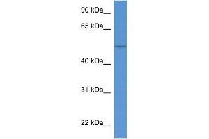 Western Blot showing KRT36 antibody used at a concentration of 1 ug/ml against Fetal Kidney Lysate (Keratin 36 antibody  (N-Term))