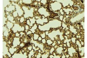 ABIN6274290 at 1/100 staining Mouse lung tissue by IHC-P.